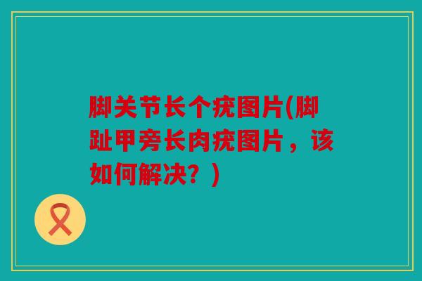 脚关节长个疣图片(脚趾甲旁长肉疣图片，该如何解决？)