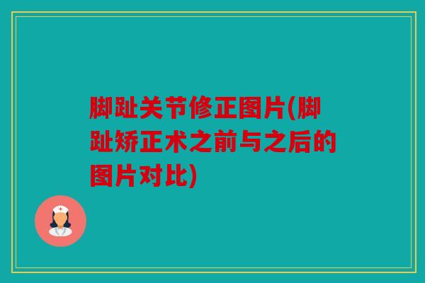 脚趾关节修正图片(脚趾矫正术之前与之后的图片对比)
