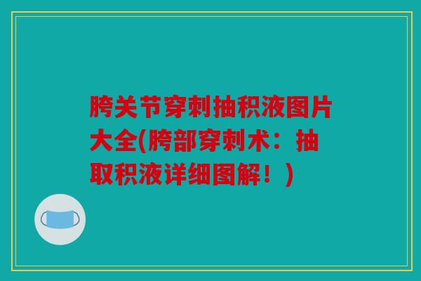 胯关节穿刺抽积液图片大全(胯部穿刺术：抽取积液详细图解！)