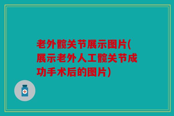 老外髋关节展示图片(展示老外人工髋关节成功手术后的图片)