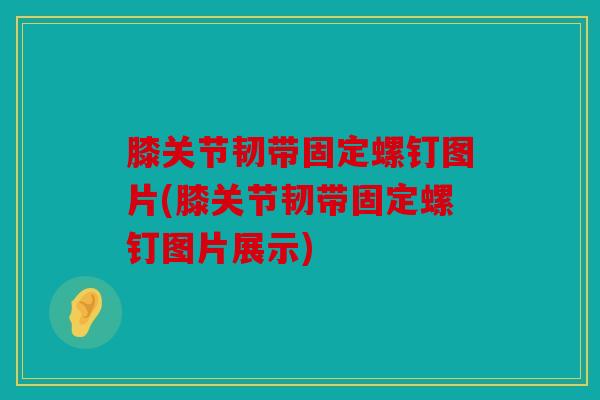 膝关节韧带固定螺钉图片(膝关节韧带固定螺钉图片展示)