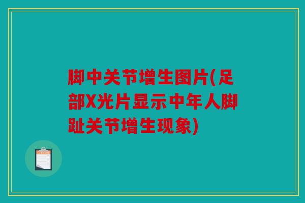 脚中关节增生图片(足部X光片显示中年人脚趾关节增生现象) 脚中关节增生图片(足部X光片显示中年人脚趾关节增生现象)
