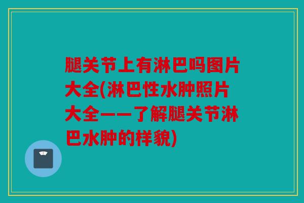 腿关节上有淋巴吗图片大全(淋巴性水肿照片大全——了解腿关节淋巴水肿的样貌) 腿关节上有淋巴吗图片大全(淋巴性水肿照片大全——了解腿关节淋巴水肿的样貌)