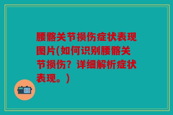 腰髂关节损伤症状表现图片(如何识别腰髂关节损伤?详细解析症状表现。) 腰髂关节损伤症状表现图片(如何识别腰髂关节损伤?详细解析症状表现。)
