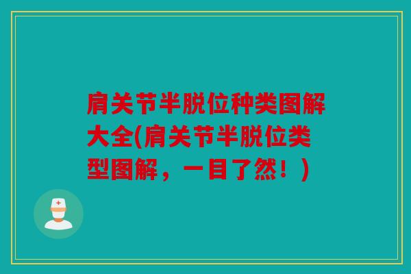 肩关节半脱位种类图解大全(肩关节半脱位类型图解,一目了然!) 肩关节半脱位种类图解大全(肩关节半脱位类型图解,一目了然!)