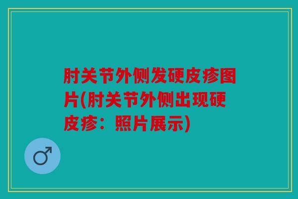 肘关节外侧发硬皮疹图片(肘关节外侧出现硬皮疹：照片展示)