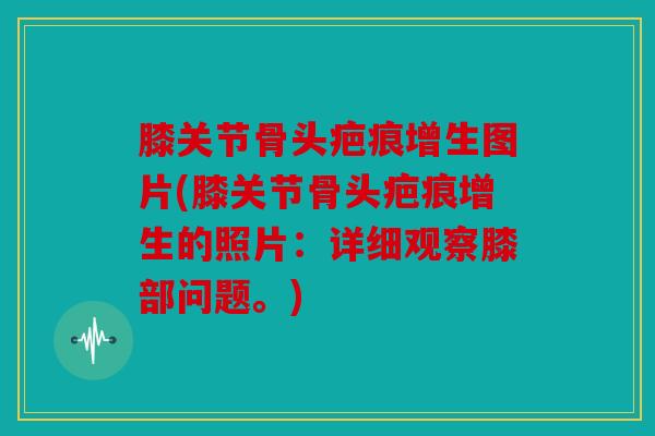 膝关节骨头疤痕增生图片(膝关节骨头疤痕增生的照片：详细观察膝部问题。)