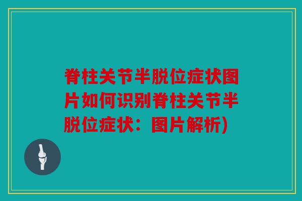 脊柱关节半脱位症状图片如何识别脊柱关节半脱位症状:图片解析) 脊柱关节半脱位症状图片如何识别脊柱关节半脱位症状:图片解析)