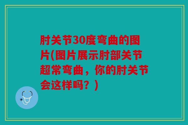 肘关节30度弯曲的图片(图片展示肘部关节超常弯曲,你的肘关节会这样吗?) 肘关节30度弯曲的图片(图片展示肘部关节超常弯曲,你的肘关节会这样吗?)