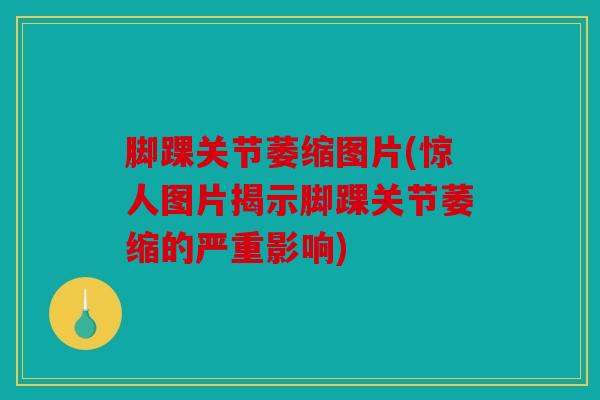 脚踝关节萎缩图片(惊人图片揭示脚踝关节萎缩的严重影响)