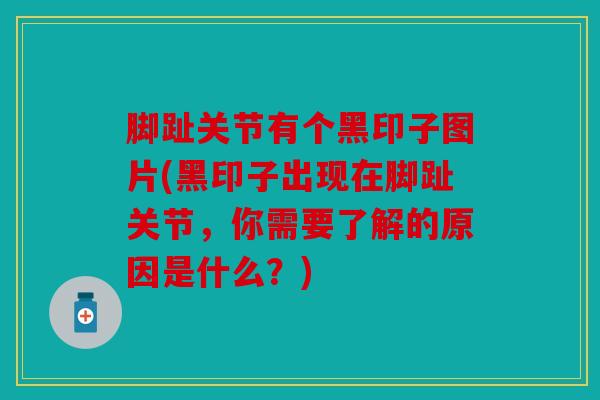 脚趾关节有个黑印子图片(黑印子出现在脚趾关节，你需要了解的原因是什么？)