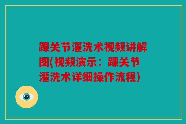 踝关节灌洗术视频讲解图(视频演示:踝关节灌洗术详细操作流程) 踝关节灌洗术视频讲解图(视频演示:踝关节灌洗术详细操作流程)